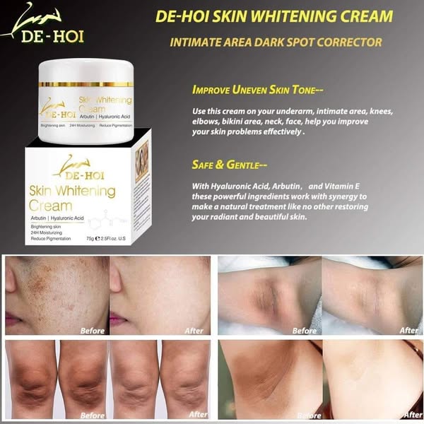 DE HOI Skin Whitening Cream – Brightening & Moisturizing Face and Body Cream for Dark Skin - 75 gram