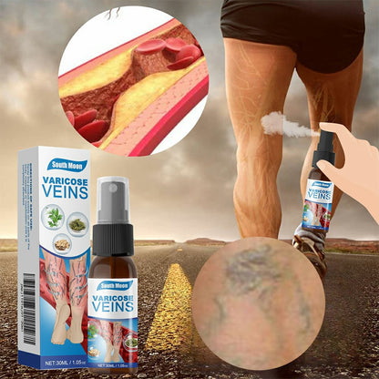 Varicose Veins Treatment Spray – Advanced Formula for Spider Veins, Leg Pain & Swelling Relief ~ 30ml
