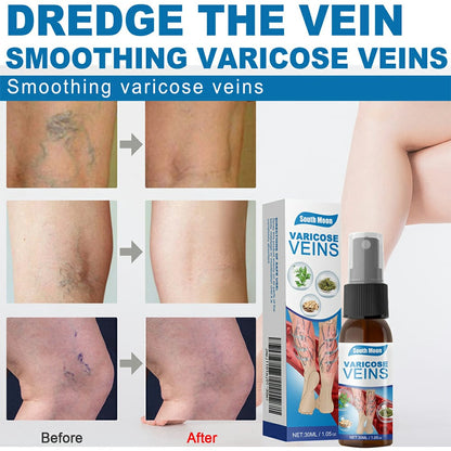 Varicose Veins Treatment Spray – Advanced Formula for Spider Veins, Leg Pain & Swelling Relief ~ 30ml